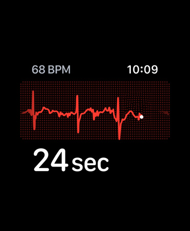 ECG app, beats per minute in top left corner, rhythm line, timer